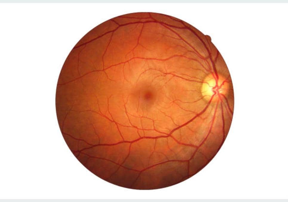 Consultations Rétine